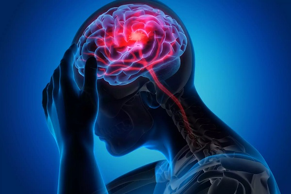 Stroke: Types, Symptoms & Emergency